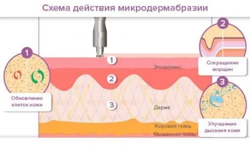 Отбеливание кожи для интимной кожи в домашних условиях. Как отбелить кожу в зоне бикини