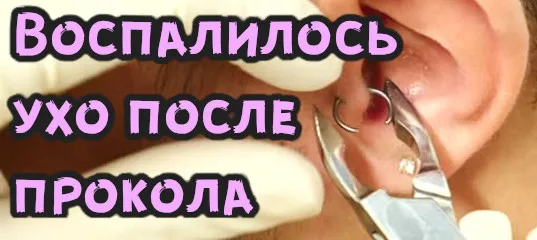 Воспаление уха после пирсинга