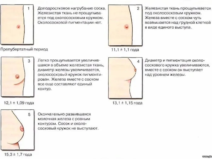 Грудь девочки проходит разные стадии развития