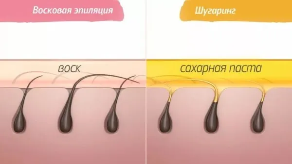 Удаление волос в домашних условиях: ноги, глубокое бикини, подмышки, лицо