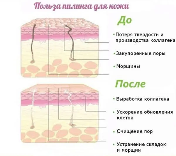 _